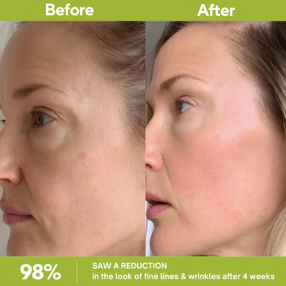 Retinal Shot Tightening Booster