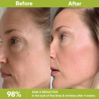 Retinal Shot Tightening Booster